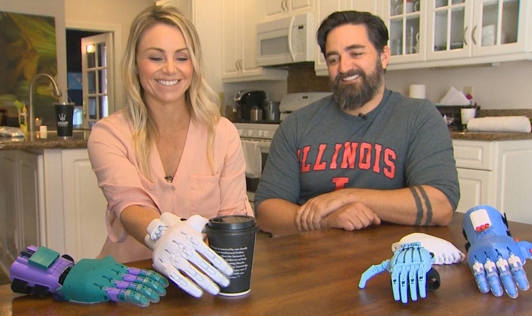 Couple Recycle Plastic Into Prosthetic Limbs
